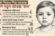 টিকা নিয়েও ১১ শতাংশ শিশু হামে আক্রান্ত: নতুন গবেষণার তাগিদ
