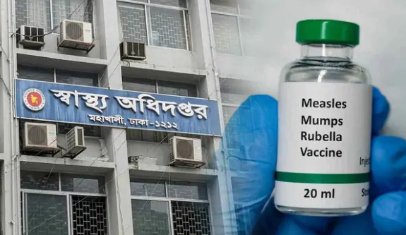 হাম ও উপসর্গে আরো ১১ শিশুর মৃত্যু, মোট ৪০৯